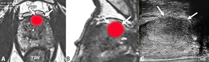 figure2-introduction-cancer